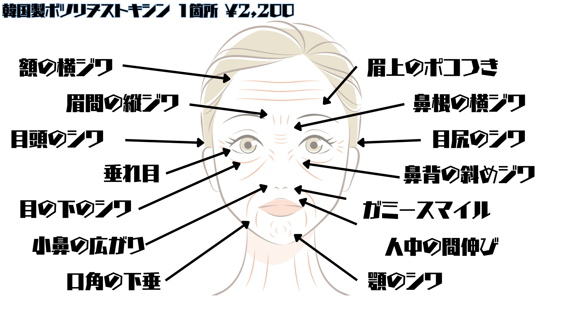 韓国製ボツリヌストキシン 1箇所 ¥2,200